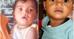 शासन की योजना से दूर हुई बेटी के भविष्य की चिंता, चिरायु दल ने लौटाई मासूम रंजना की मुस्कान…