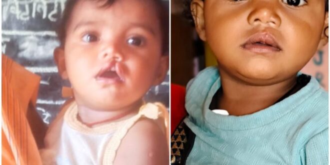 शासन की योजना से दूर हुई बेटी के भविष्य की चिंता, चिरायु दल ने लौटाई मासूम रंजना की मुस्कान…