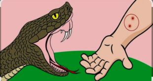 वर्षा ऋतु में सर्पदंश से सतर्क रहें: स्वास्थ्य विभाग बेमेतरा की अपील  
